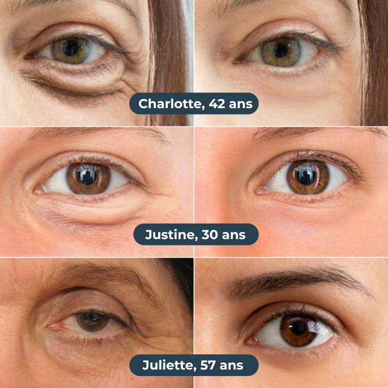 Patchs Anti-Cernes Nouvelle Génération